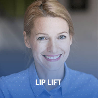 Smiling woman in a blue shirt, celebrating her successful lip lift treatment in Dallas, Texas