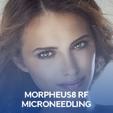 Beautiful woman posing for images related to micro-needling treatment in Dallas, TX