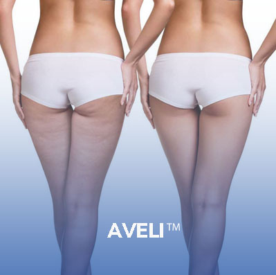 Image depicting Before and after treatment of Aveli in Dallas, Texas.