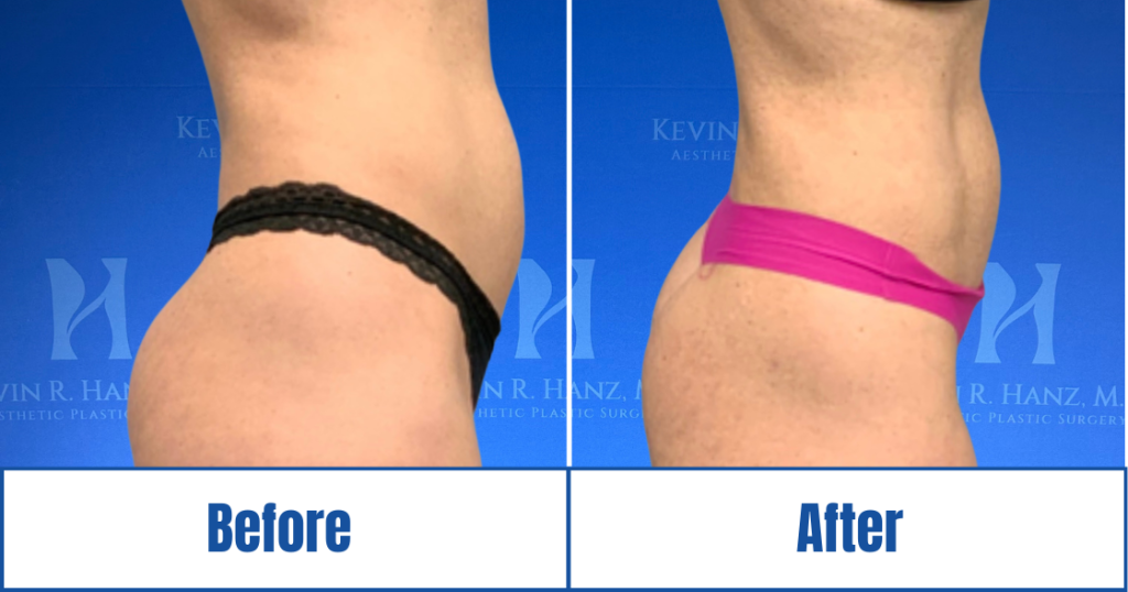 New Website before and afters (1120 x 588 px) – 101