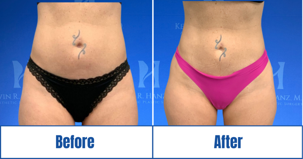 New Website before and afters (1120 x 588 px) – 102