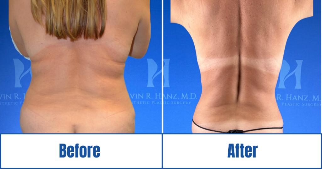 New Website before and afters (1120 x 588 px) – 28