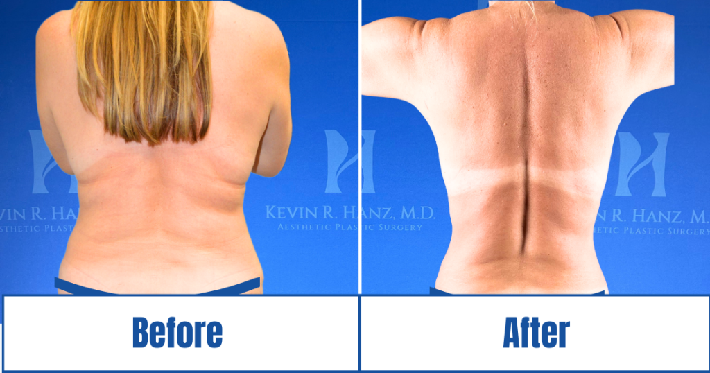 New Website before and afters (1120 x 588 px) – 31