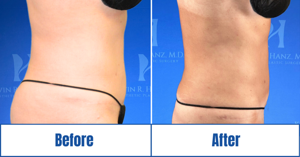 New Website before and afters (1120 x 588 px) – 34