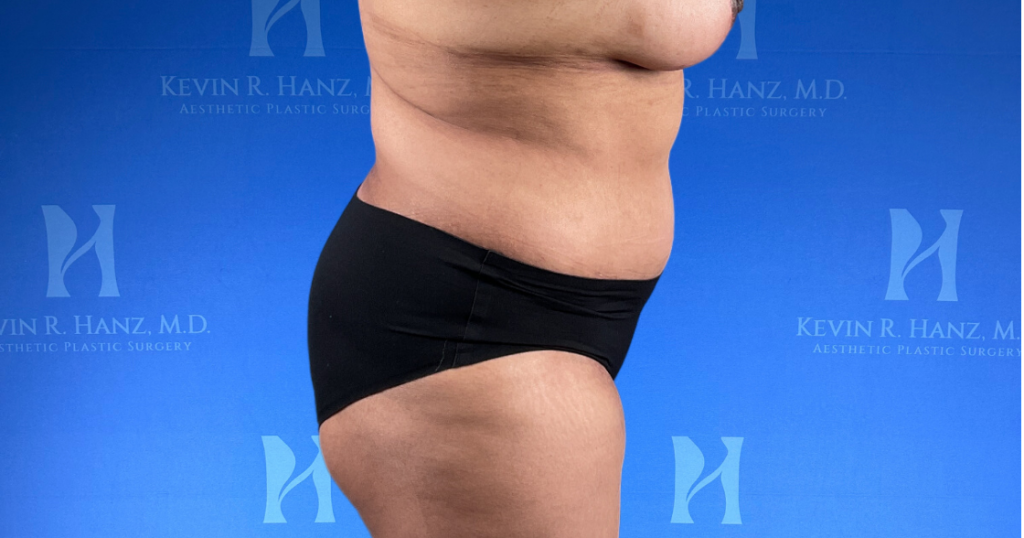 New Website before and afters (1120 x 588 px) – 85