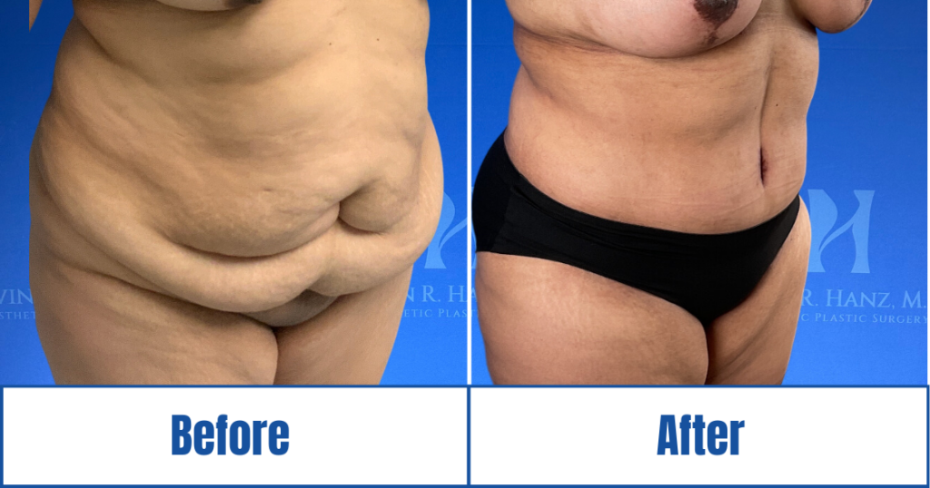 New Website before and afters (1120 x 588 px) – 86