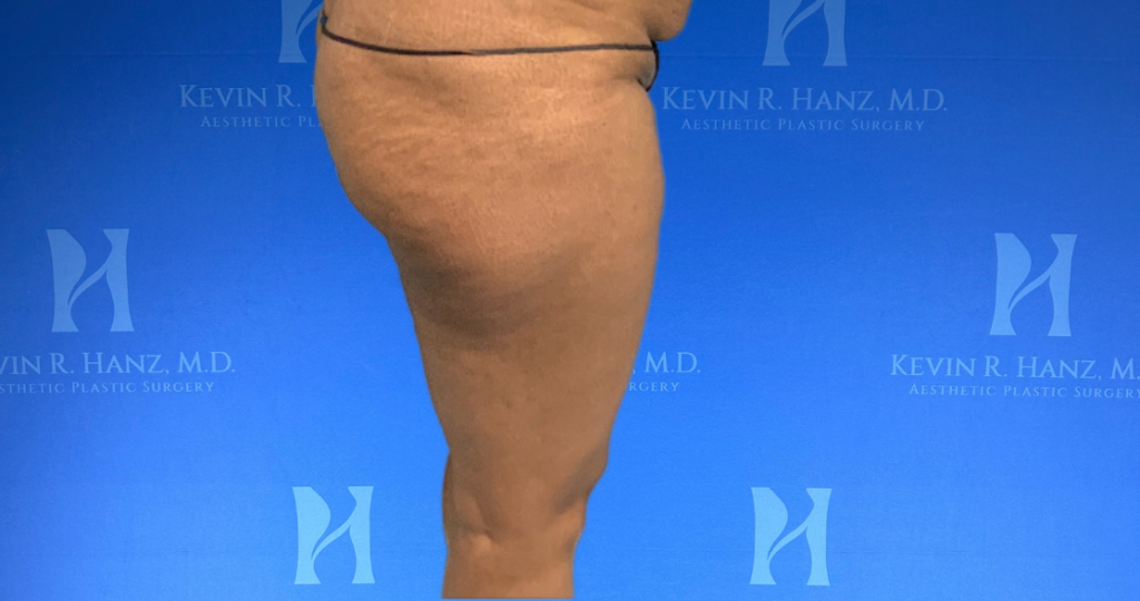 125