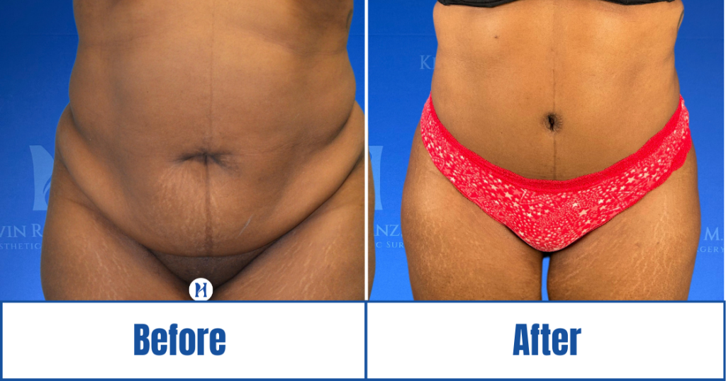 New Website before and afters (1120 x 588 px) – 103