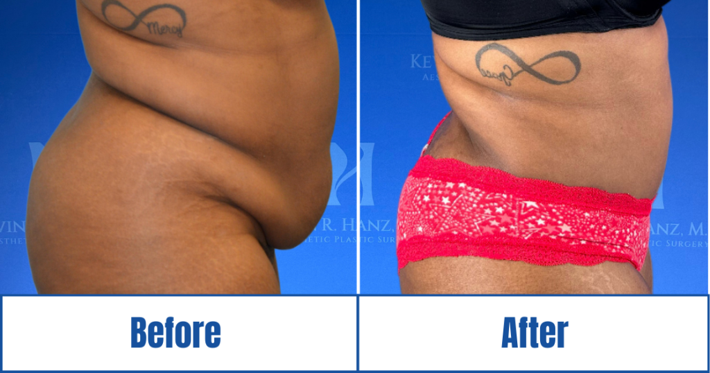 New Website before and afters (1120 x 588 px) – 106
