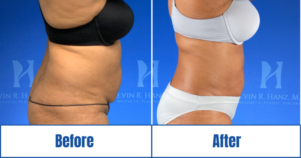 New Website before and afters (1120 x 588 px) – 117