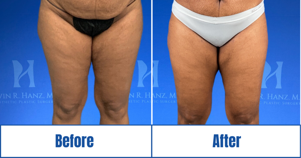 New Website before and afters (1120 x 588 px) – 120