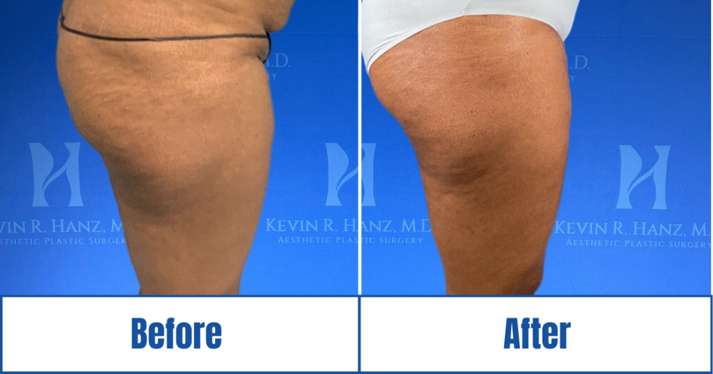 New Website before and afters (1120 x 588 px) – 123