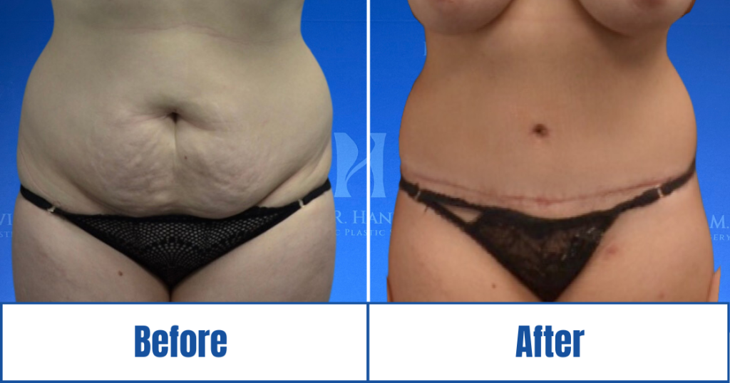 New Website before and afters (1120 x 588 px) – 16
