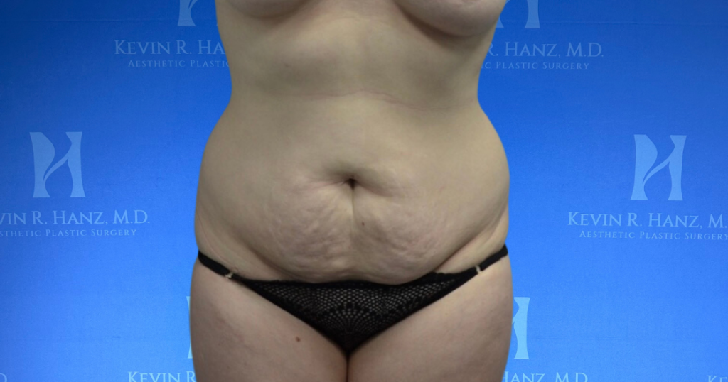 New Website before and afters (1120 x 588 px) – 18