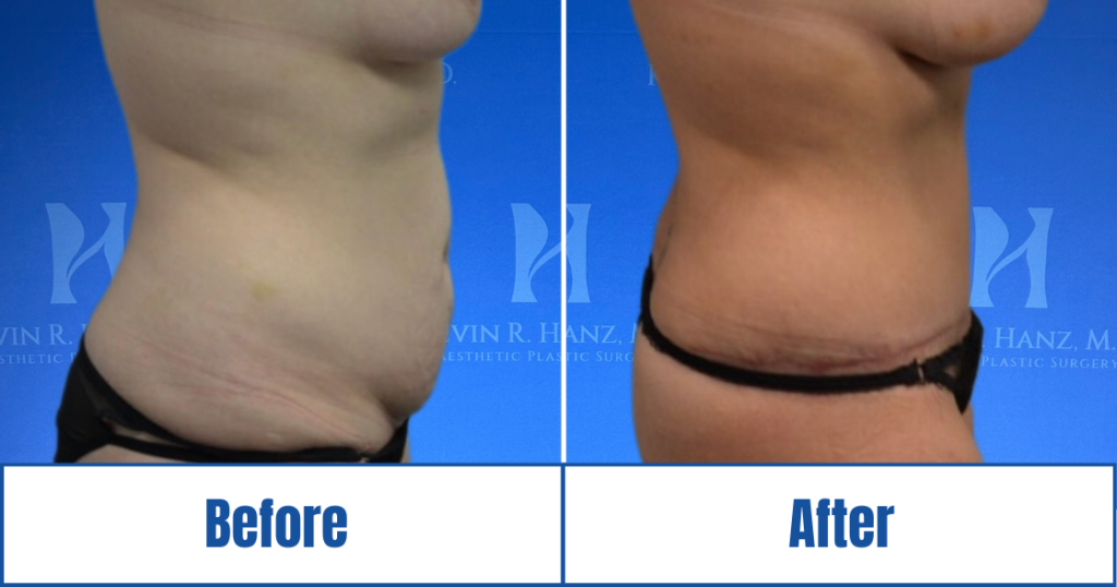 New Website before and afters (1120 x 588 px) – 19