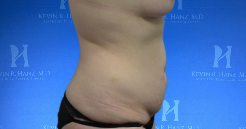 New Website before and afters (1120 x 588 px) – 20