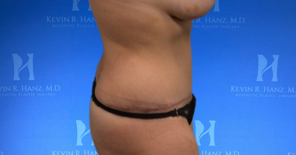 New Website before and afters (1120 x 588 px) – 21