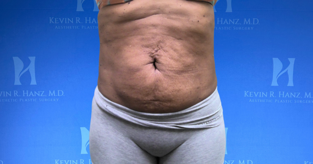 New Website before and afters (1120 x 588 px) – 23