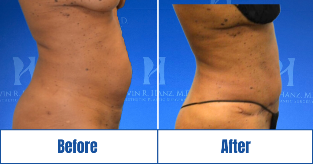 New Website before and afters (1120 x 588 px) – 25