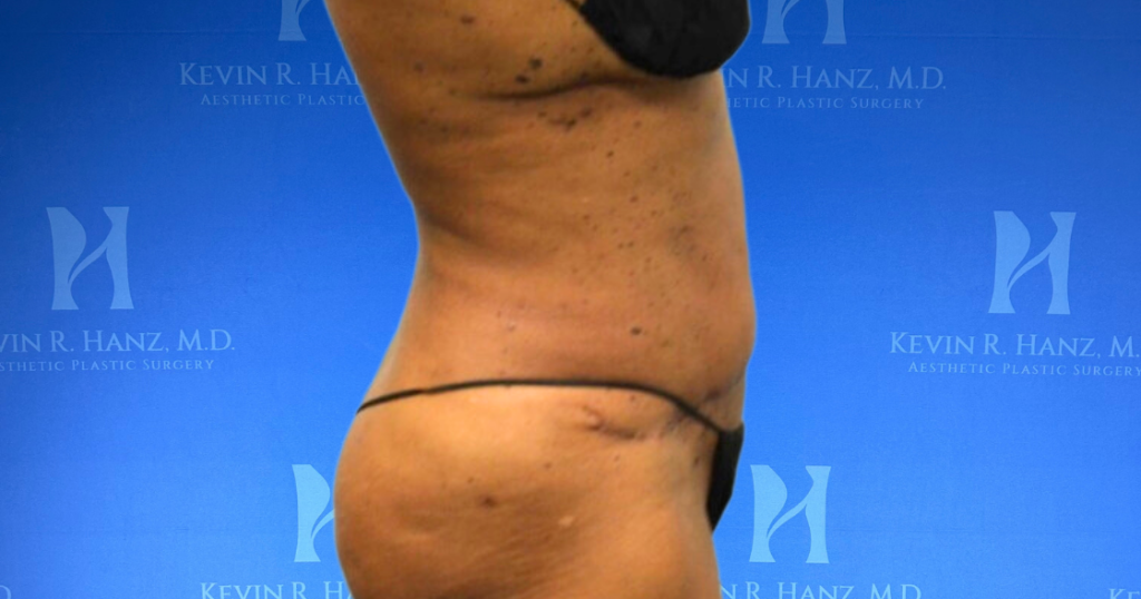 New Website before and afters (1120 x 588 px) – 27