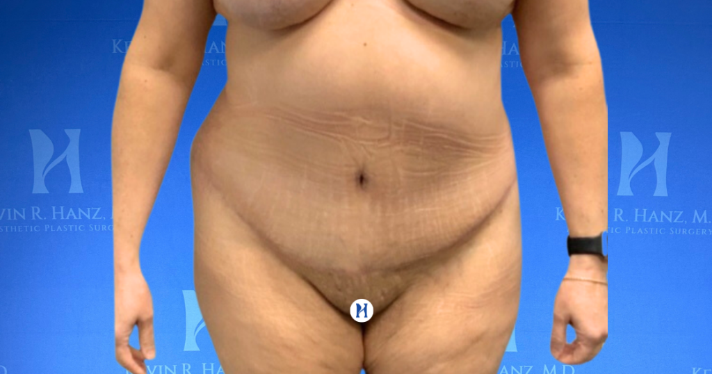 New Website before and afters (1120 x 588 px) – 40