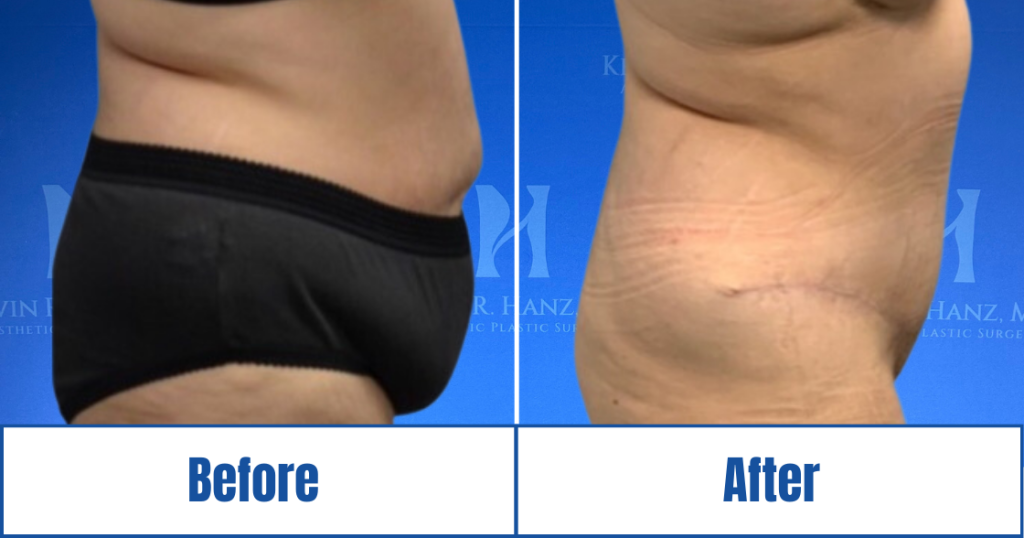 New Website before and afters (1120 x 588 px) – 41