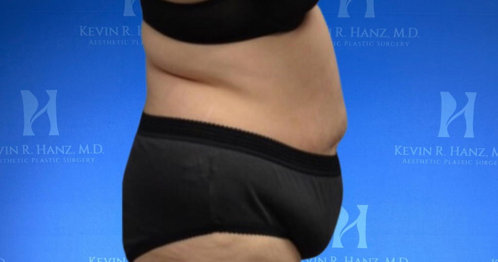 New Website before and afters (1120 x 588 px) – 42