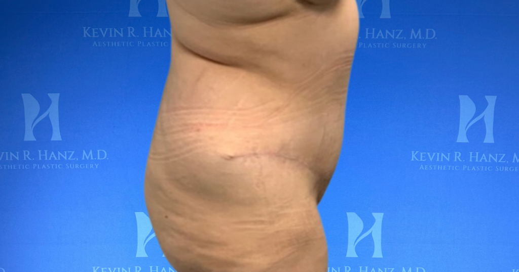 New Website before and afters (1120 x 588 px) – 43