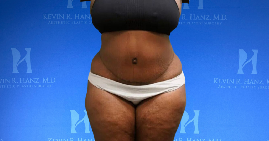 New Website before and afters (1120 x 588 px) – 52