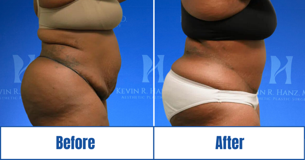 New Website before and afters (1120 x 588 px) – 53