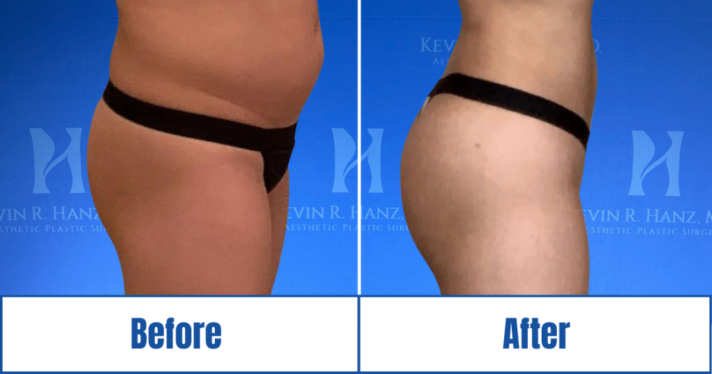 New Website before and afters (1120 x 588 px) – 59