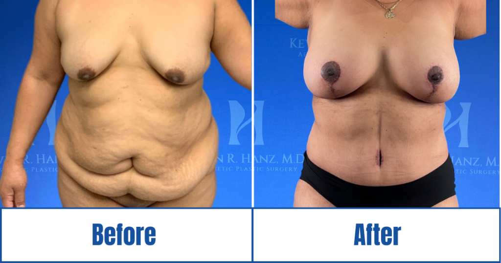 New Website before and afters (1120 x 588 px) – 71