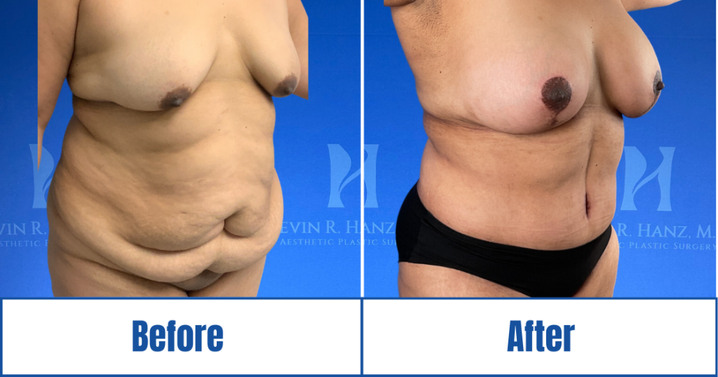 New Website before and afters (1120 x 588 px) – 74
