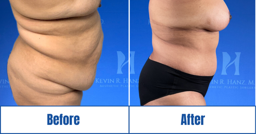 New Website before and afters (1120 x 588 px) – 77