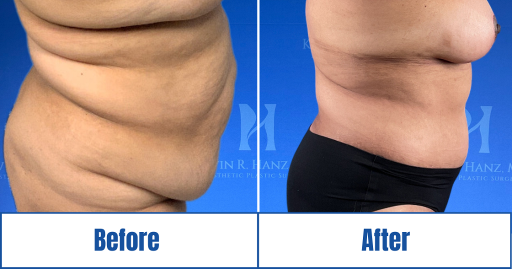 New Website before and afters (1120 x 588 px) – 92