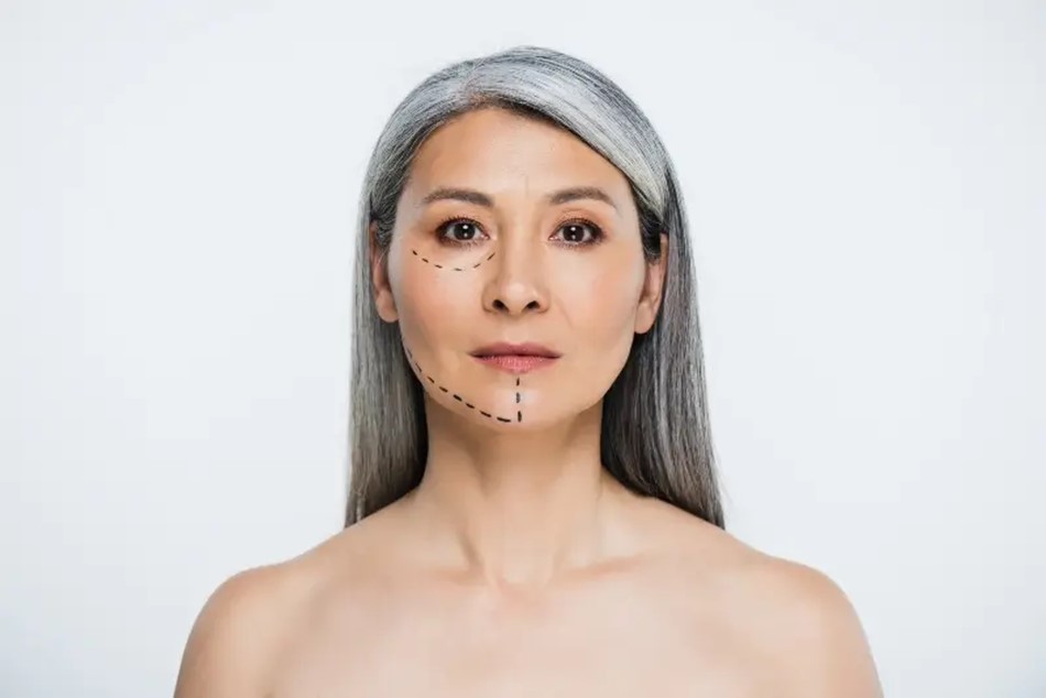 Mature woman ready for facelift surgery