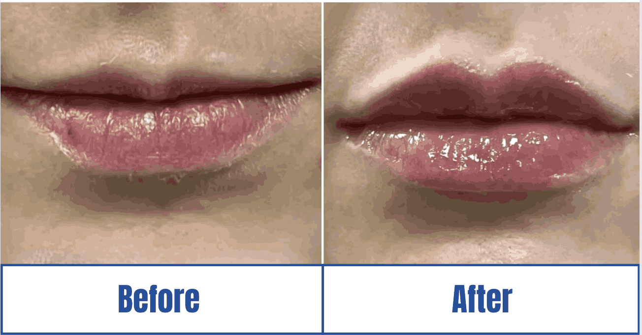 Plastic Surgery Outcome Display in the Dallas-Fort Worth Metropolitan Area