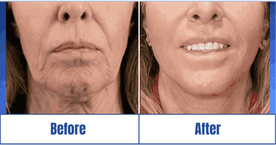 Facial aesthetics consultation and planning in the Dallas-Fort Worth Metropolitan Area